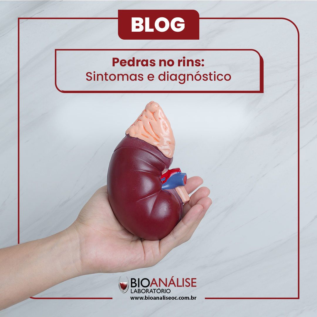 Pedras nos rins: sintomas e diagnóstico