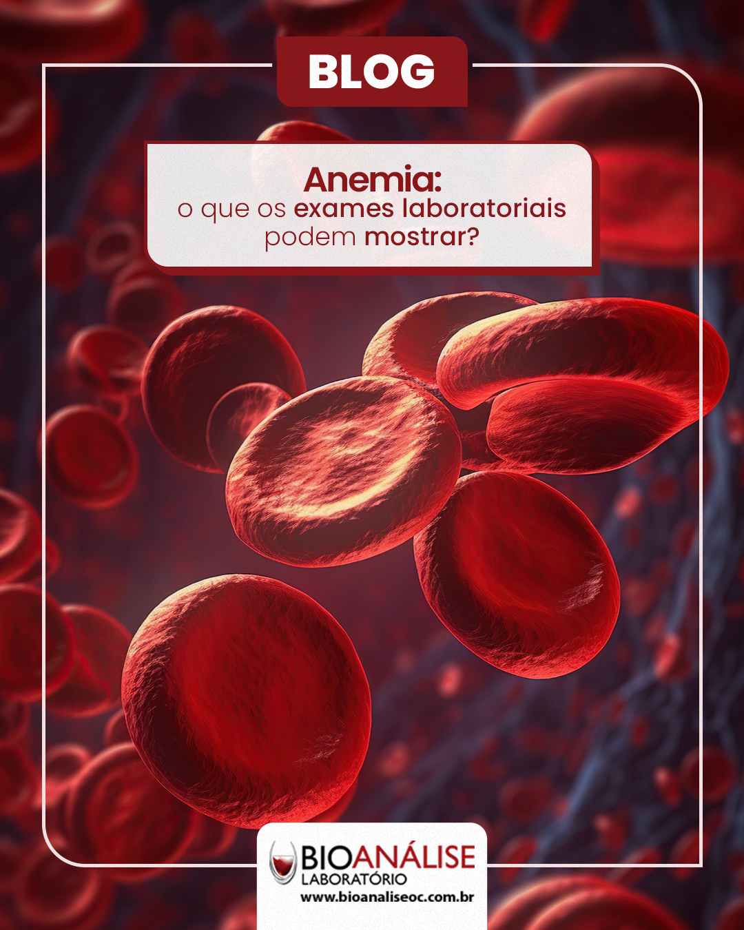 Anemia: o que os exames laboratoriais podem mostrar?