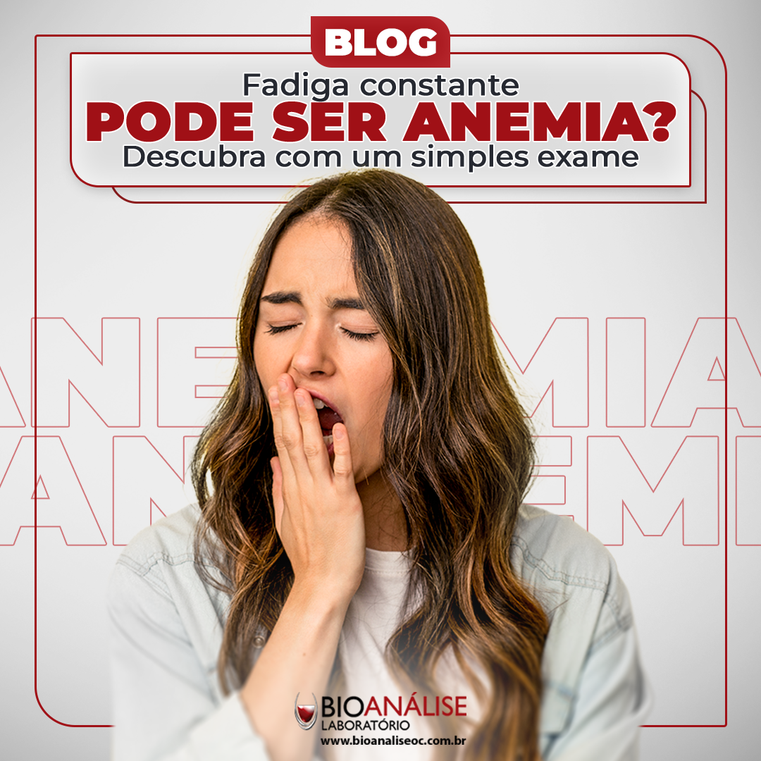 imagem de exibicao