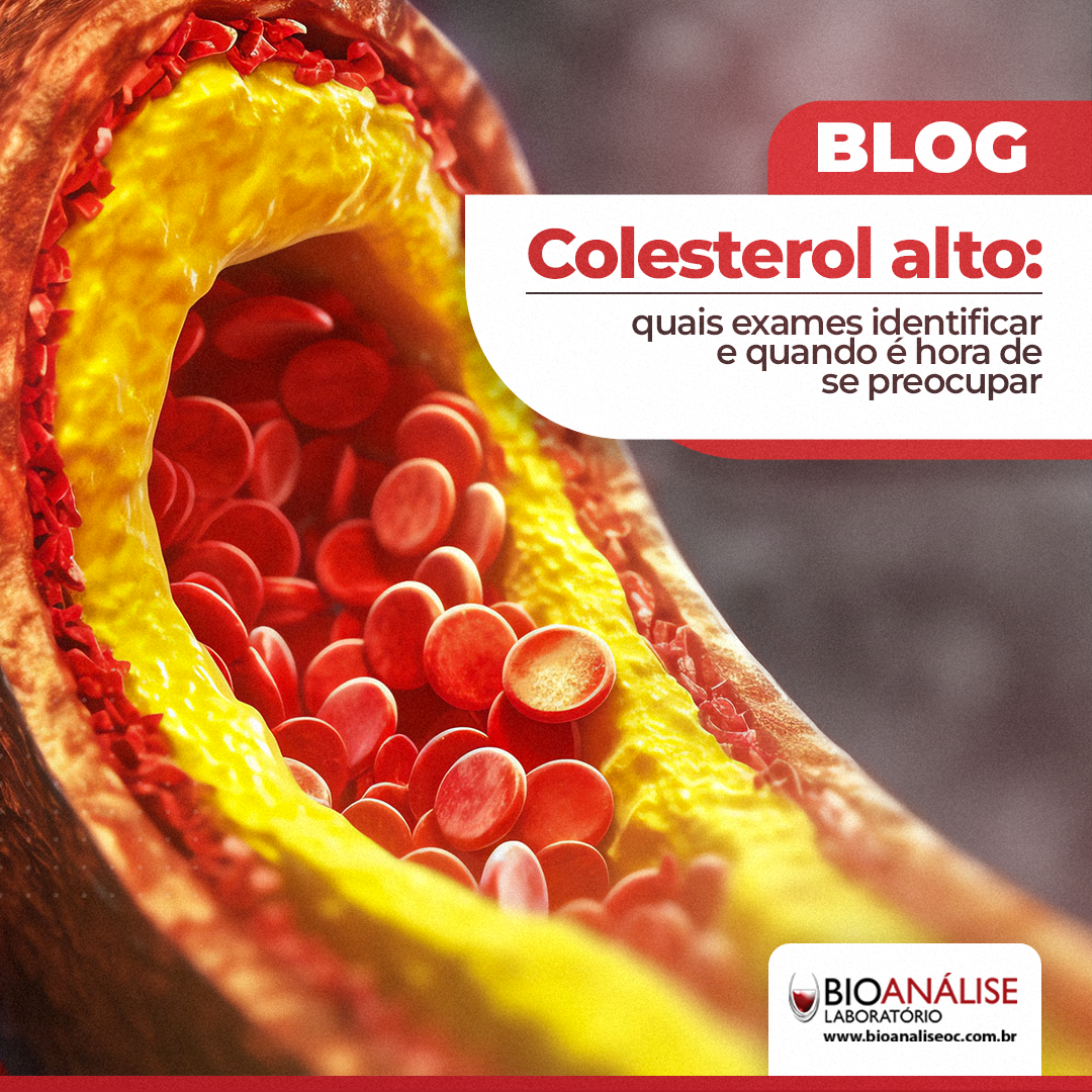 Colesterol Alto: Quais Exames Identificar e Quando é Hora de se Preocupar