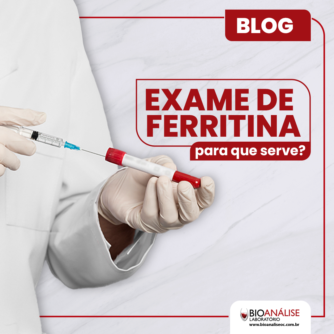 imagem de exibicao